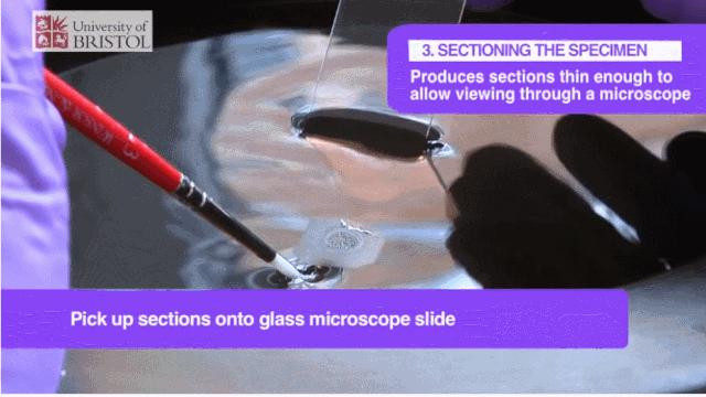 病理报告为什么这么慢,手术后病理报告准确率高吗