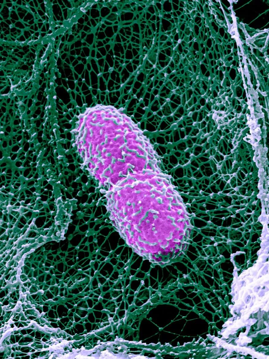 感染病毒后的168小时，你的体内都发生了什么？