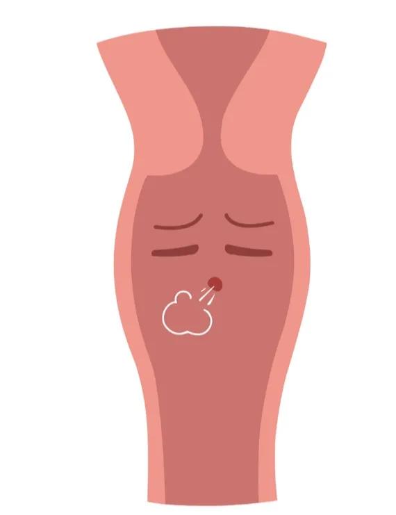 妇产科需要检查哪些项目,妇产科超声检查是什么检查项目