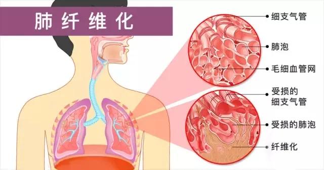 研究新冠病毒的最新技术设备,国内关于新冠病毒科研创新