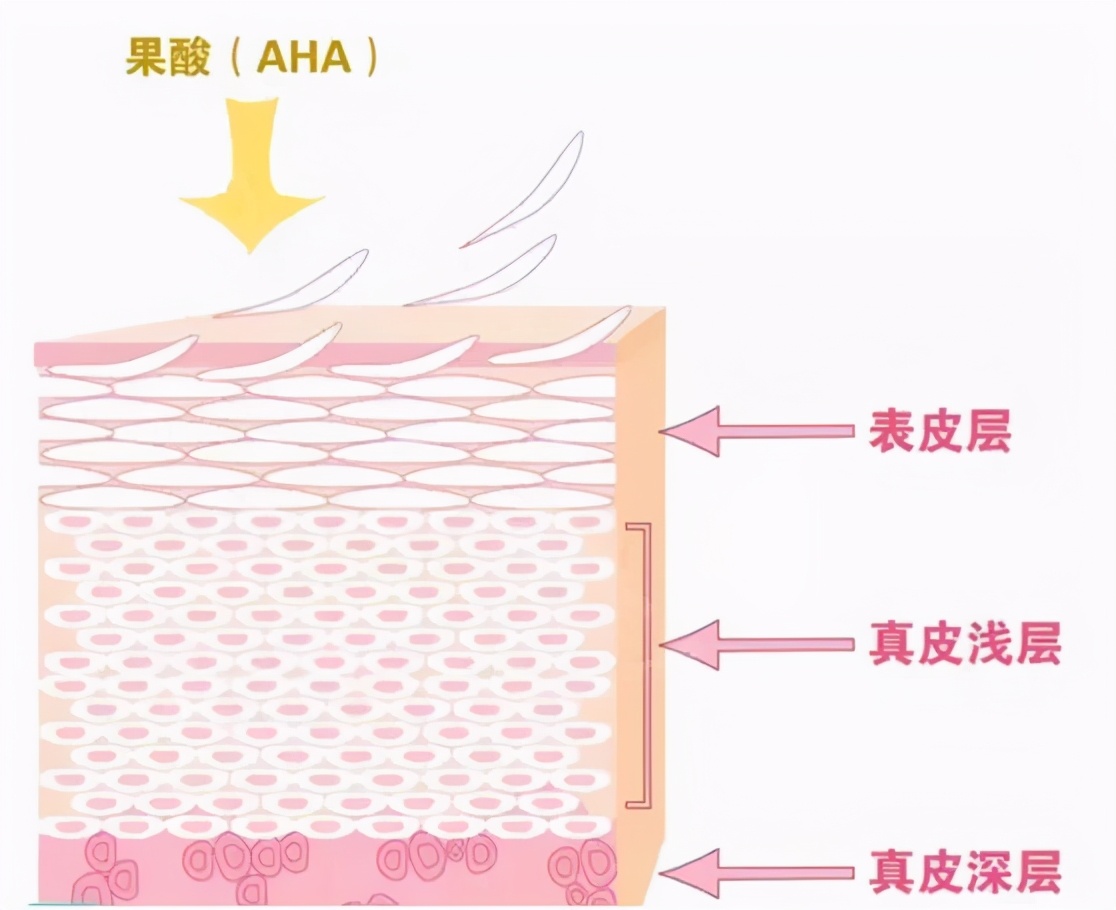 皮肤太黑被人嘲笑怎么办,皮肤暗黄十大救星