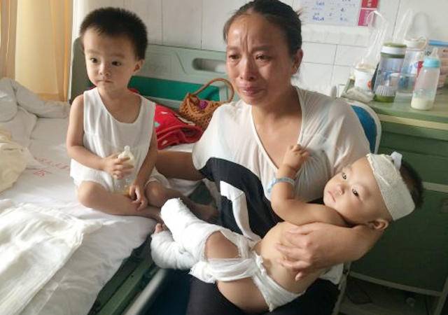 小孩热水烫伤长泡需要把泡刺破吗,小孩烫到起泡多久会恢复