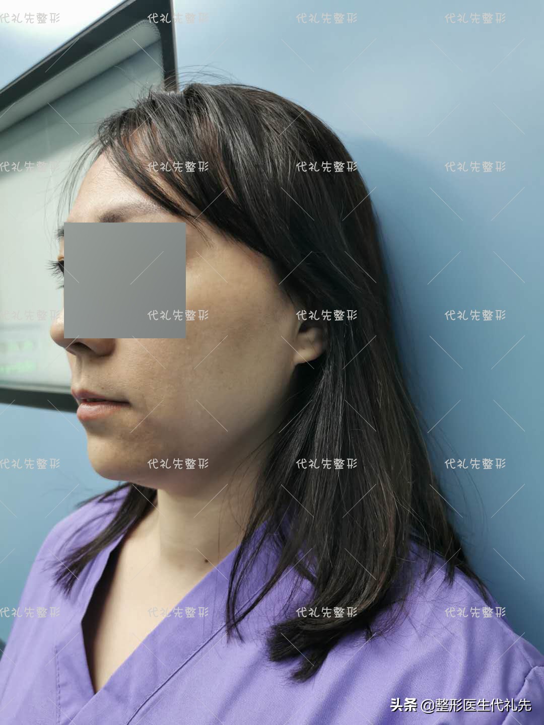 怎样才能拥有完美的下颌线,怎样让自己的下颌线更明显