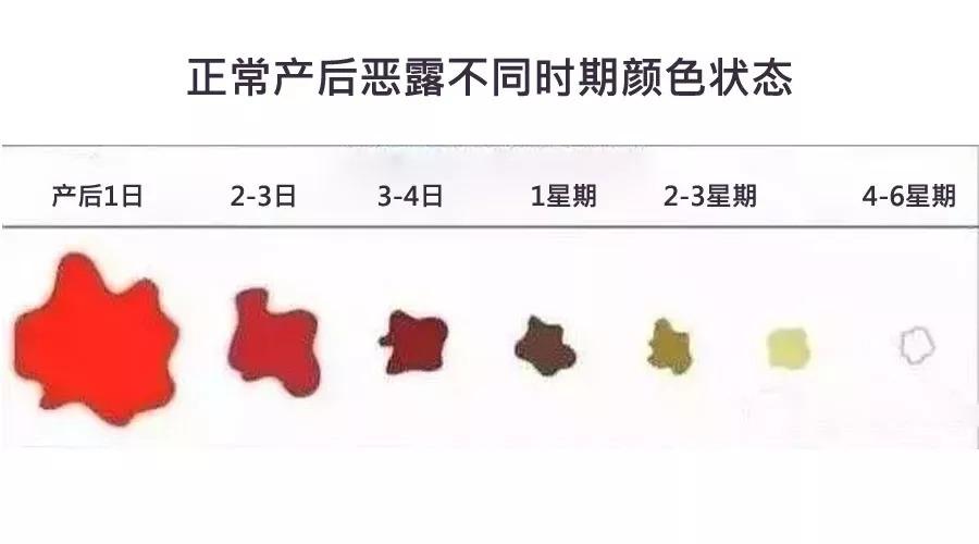 新妈妈的烦恼——产后恶露何时结束？