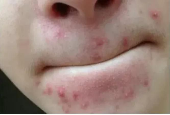 长期使用美容仪斑会淡吗,长期使用美容仪皮肤会提亮吗