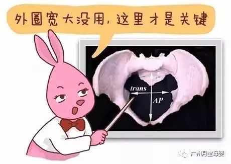 屁股大的女生好生养,屁股大的女人适合生孩子吗