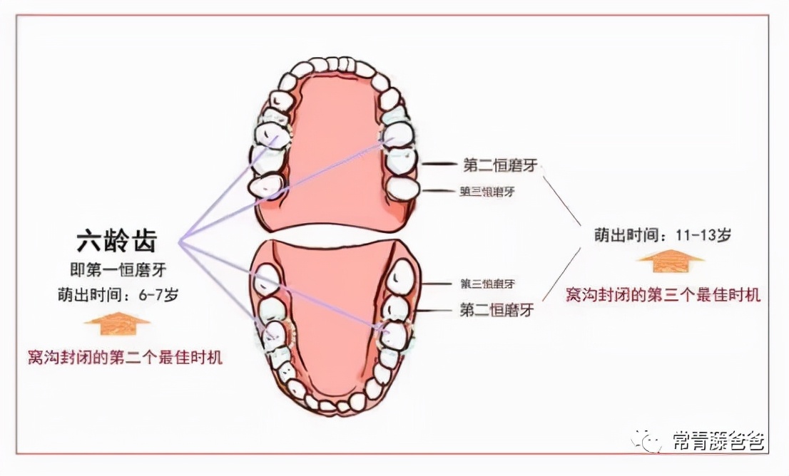 6-12岁换牙怎么换一口好牙,7岁换牙期注意事项怎么才整齐