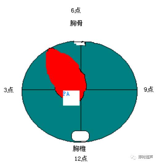 胎儿心室三种血管关系模式图,25周的胎儿心室弓切面多少正常