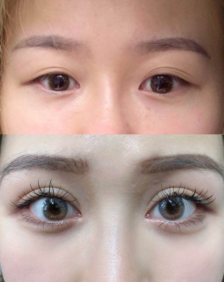 双眼皮外眼角有必要开吗,看完再决定要不要入坑