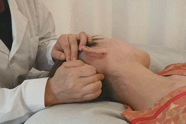 天津口碑好的中医推拿培训机构,天津拔罐