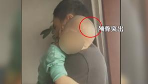 郴州大头娃娃,郴州大头娃娃事件真实原因