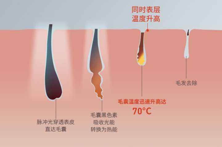 女生脸上的小胡子越长越多怎么办,女生脸上小胡子怎么去