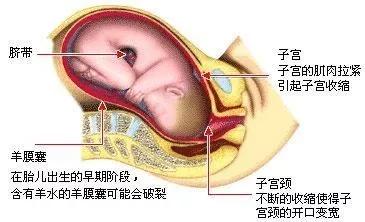孕期阴道炎的种类及症状,孕期阴道炎的原因及措施
