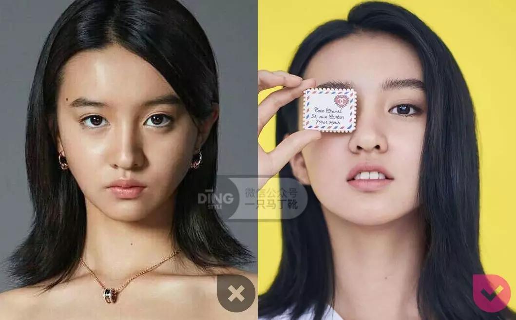 戴牙套凸嘴怎么化妆,凸嘴整牙削骨吗