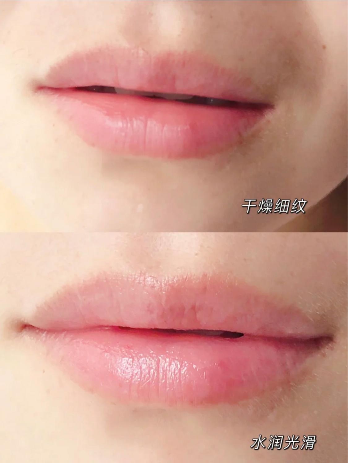 嘴唇变丑的十大坏习惯,这几个习惯会使嘴唇变得越来越厚