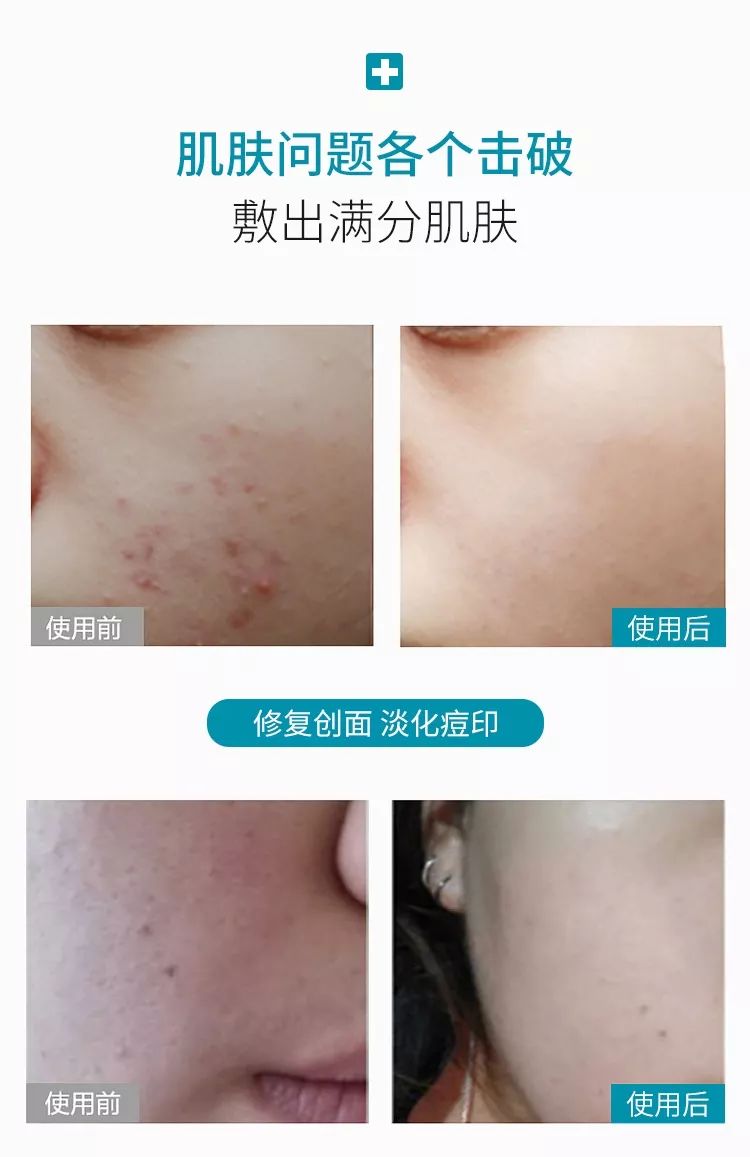 械字号面膜代加工厂家哪家好,械字号面膜加盟公司