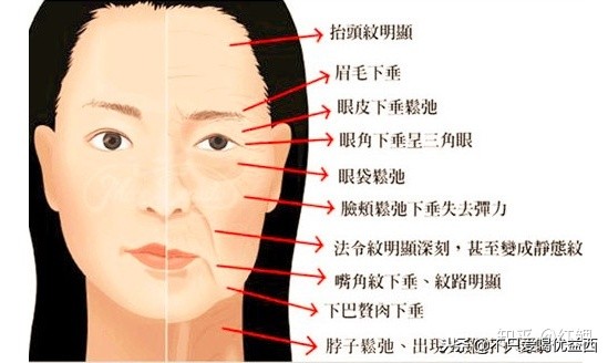 脸部皮肤松弛怎么紧致,怎么才能让脸瘦下来