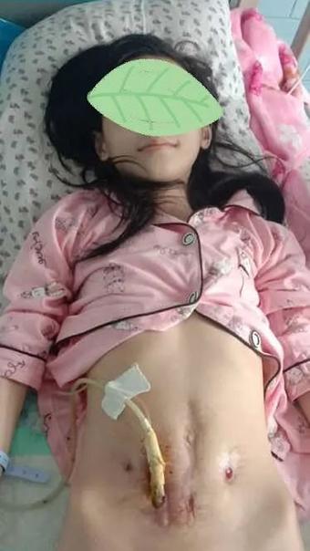 追问医院排行榜：已经死的，能不死吗？活受罪的，到底谁能治？