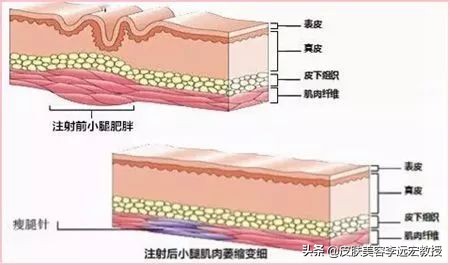 大腿小腿增粗怎么练,大腿粗小腿结实怎么办
