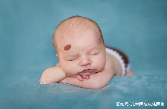 如何辨别宝宝是红胎记还是血管瘤,宝宝身上青一块紫一块图片