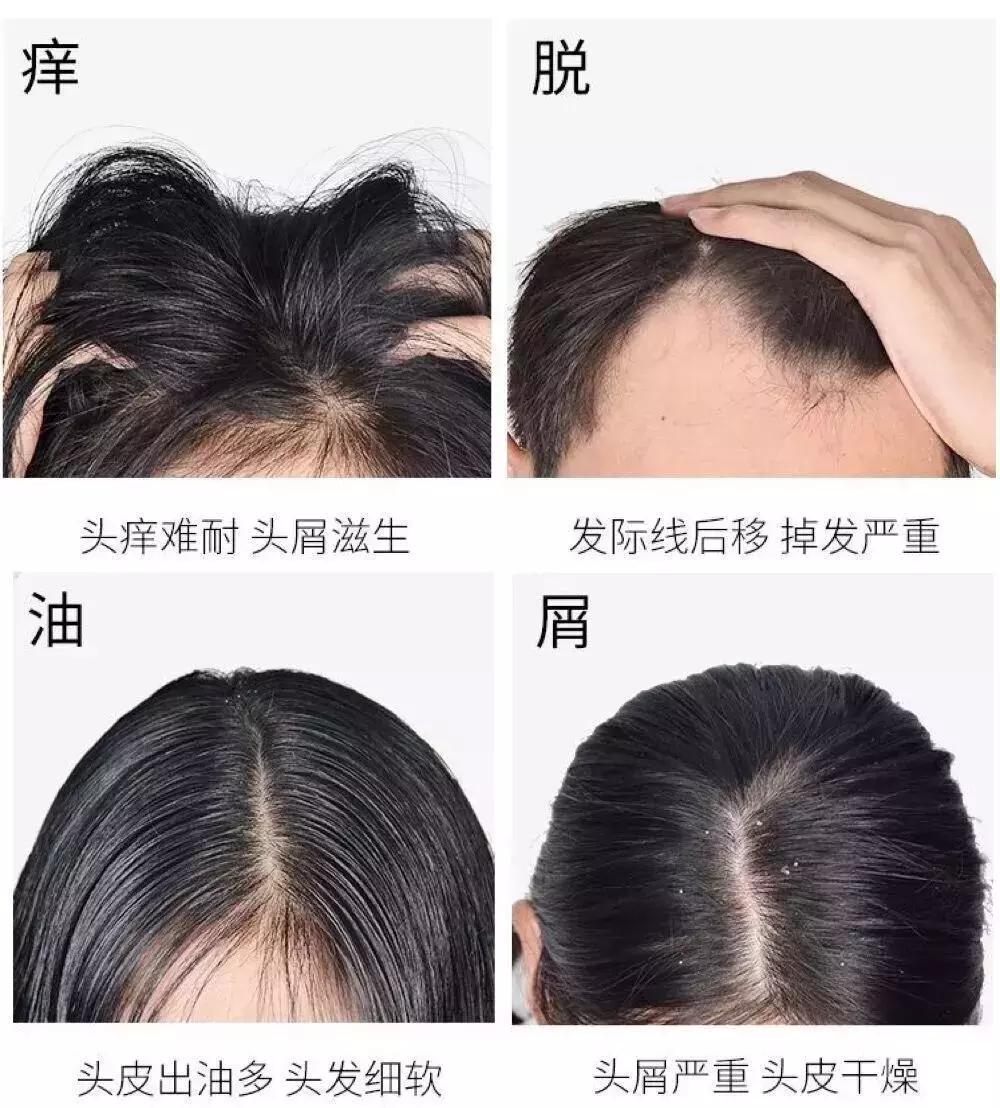 用什么洗发才能变得乌黑闪亮,用什么洗发水能让头发浓密乌黑