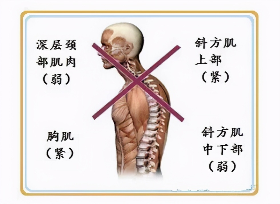 背部挺拔笔直怎么锻炼,背部挺拔身姿锻炼哑铃