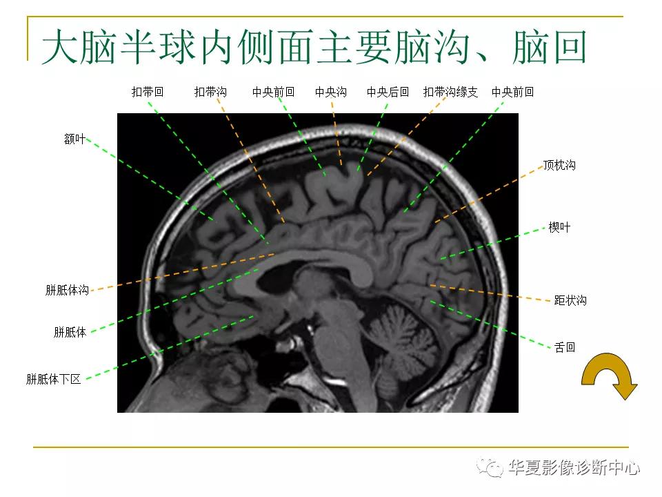 中国人脑立体定向mri应用解剖图谱,脑mri示意图