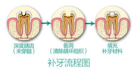 北京精德口腔详解要不要洗牙,精德口腔北京