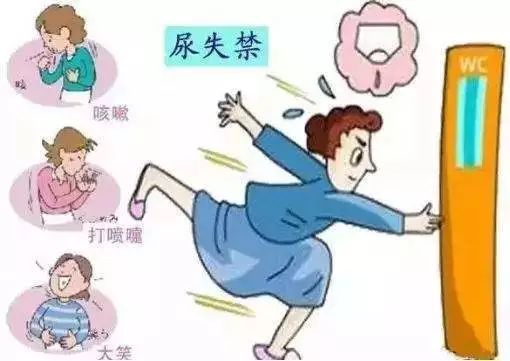 产后修复盆底肌凯格尔运动广告,产后多久可以做盆底肌修复运动
