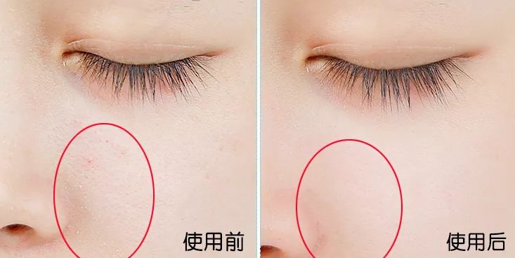 卖疯了！澳洲平价绵羊油，秋冬补水保湿首选，一罐用全身，英国女王都打call