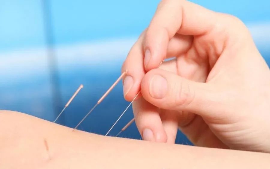 针灸大成原版价值,针灸大成是什么书