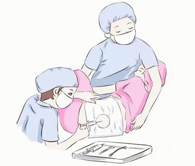 生小孩可以全程无痛吗,生孩子也可以无痛吗