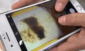 约会的前一天长了个痘,约会之前必长痘