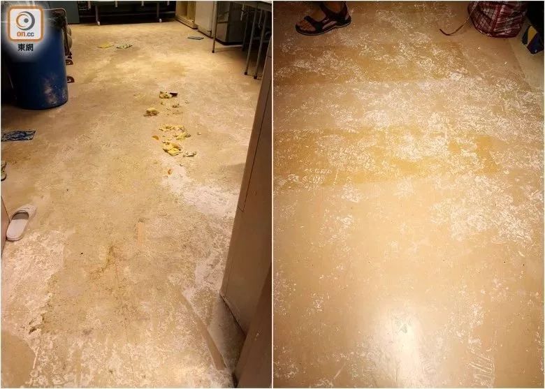 过生日被烫伤意味着什么,大学生吃火锅被烧伤