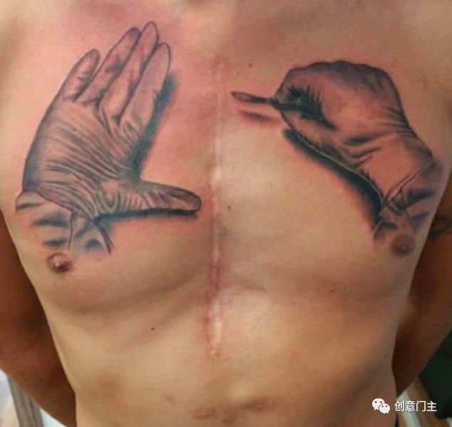 去除纹身疤痕最好的方法,疤痕纹身怎么去除