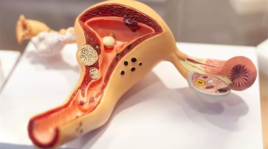 宫颈糜烂要不要治,宫颈糜烂到底要不要治疗