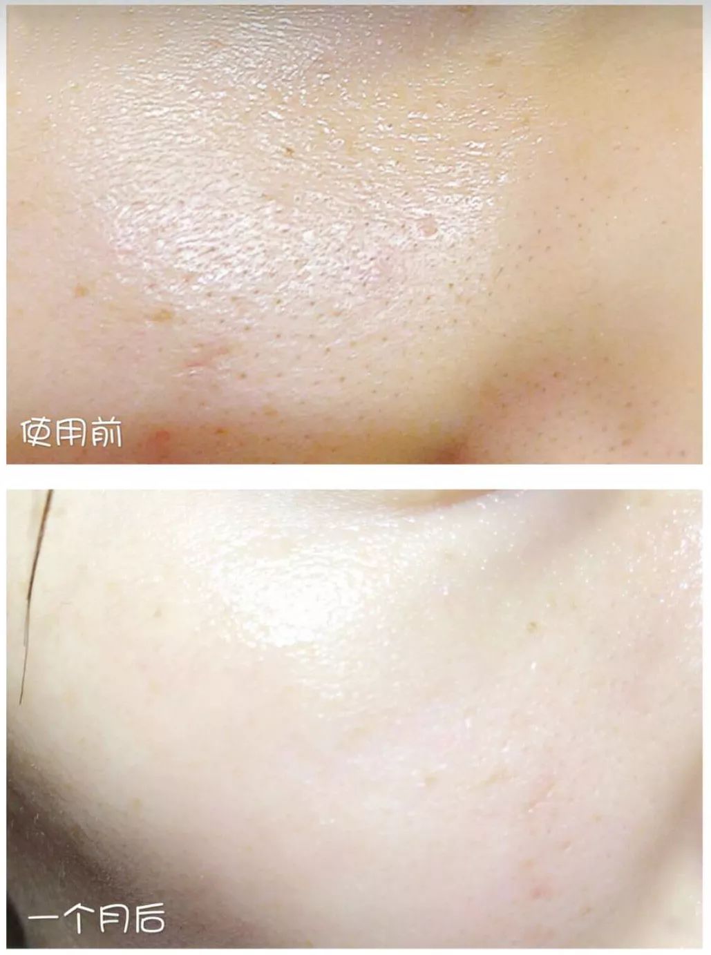 安瓶补水紧致提拉去皱精华,嫩白抗皱安瓶精华