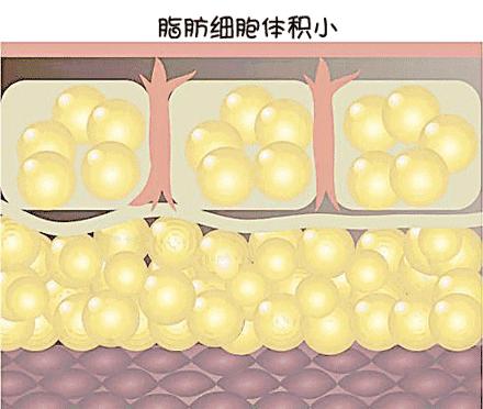 假小子变装惊艳全场的样子,肿眼泡假小子