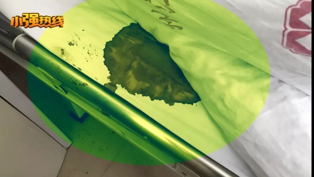 做完手术放血,手术成功术后出血死亡