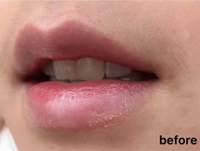 现在最好的脱毛产品,夏季脱毛都什么价位