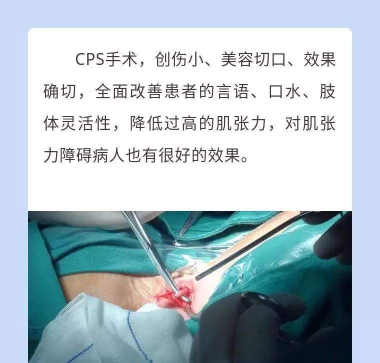 四川脑瘫康复方法,脑瘫男童康复中心