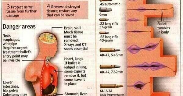 人体中弹会怎么样,人体中枪后果