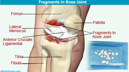 人体中弹会怎么样,人体中枪后果