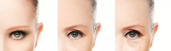 老牌子熬夜黑眼圈眼霜推荐,去眼纹的眼霜推荐20岁