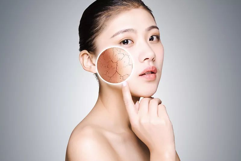 痘印红血丝修复护肤品平价,痘印泛红团购