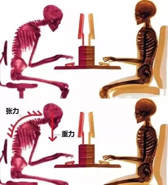 看电脑久了脖子酸疼怎么缓解,天天刷手机脖子痛