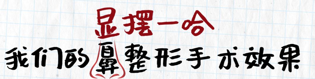 长鼻子如何通过整容改善,鼻子到底应该怎么修