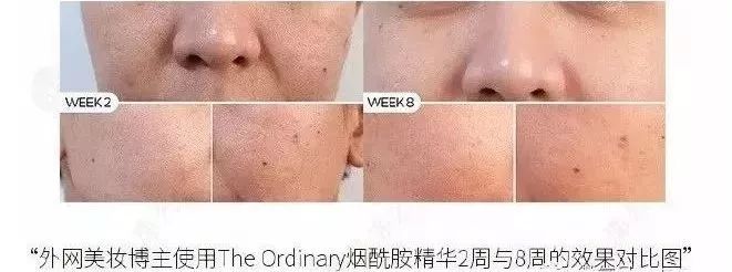 美白保湿平价精华推荐,米白精华平价好用