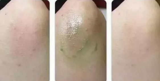 泰国驱蚊子膏,泰国蚊子驱蚊神器