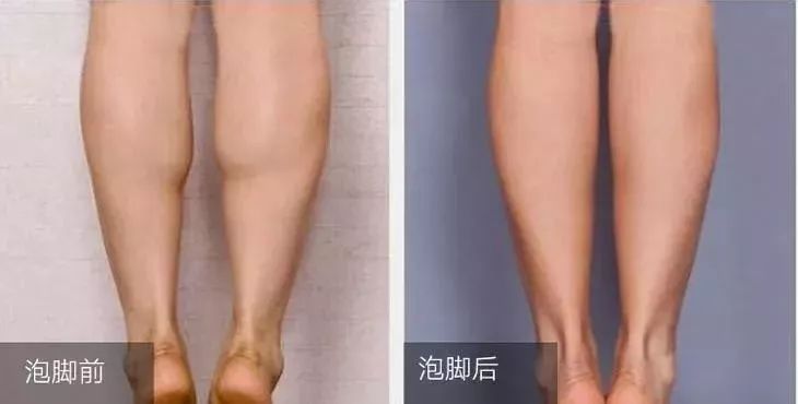 秋冬泡脚加点它,天冷了用这种方法泡脚更有利健康